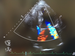 心臓超音波検査 画像